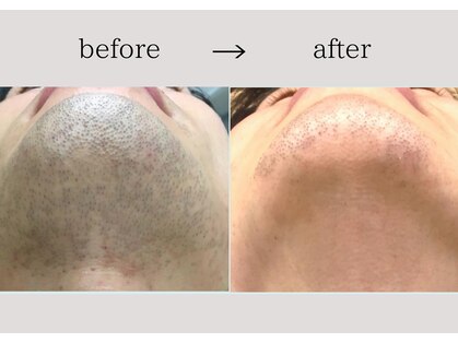 アネーロ(anhelo)の写真