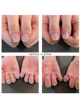 ホホホ(hohoho)/自爪ネイルケア・手肌のケア