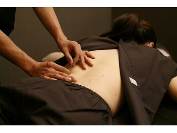 スターズ鍼灸整骨院 学芸大学院/鍼灸施術