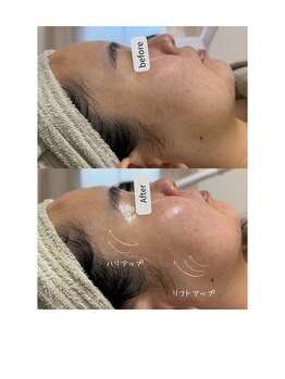 プアラ(puala)/ボンバーフェイシャル