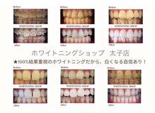 ホワイトニングショップ 太子店