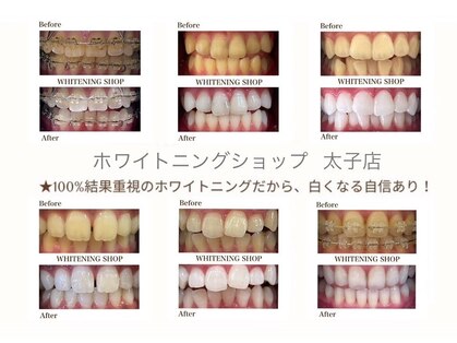 ホワイトニングショップ 太子店の写真