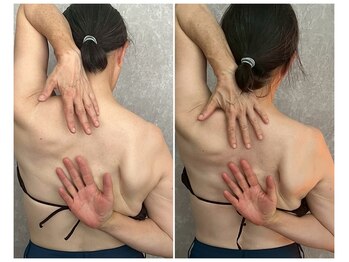 マイティー整骨院 ココア(CoCoa)/肩甲骨洗浄