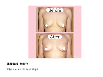 アップオー 天神大名店(up O)/