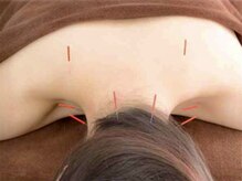 鍼灸ハリカラの雰囲気（【首肩コリ・腰痛・自律神経】鍼灸×整体×矯正で根本から改善◎）