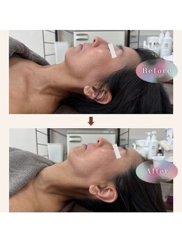 ジェイド(Jade)/初回のbefore→after