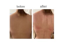 八王子エリア希少☆ハーブテントで代謝UP &痩身効果○