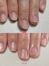 ワイ(Y)/ネイルケア/自爪育成