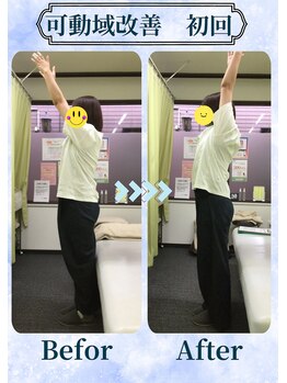 アミーゴ整体院/ビフォーアフター