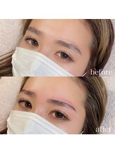 ダリ(Dali)/ハリウッドブロウリフト