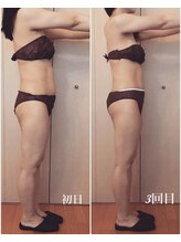 アンフィニ(infini)/短期集中コース全身5回(2ヶ月)