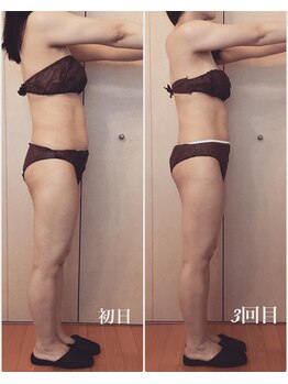 アンフィニ(infini)/短期集中コース全身5回(2ヶ月)