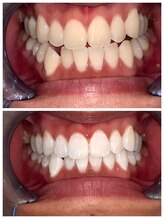 ライトビューティー 池袋店(LightBeauty)/症例写真