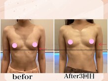 プレジィール/バストアップ/バストケア/育乳