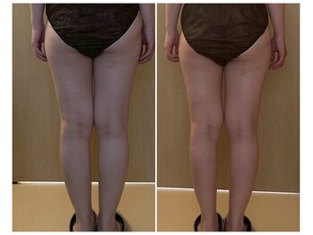 マイティー整骨院 ココア(CoCoa)/活性リンパ洗浄