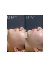 ピュアソル 奈良店(Puresol)/ララピール