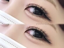 アンベリール(embellir)