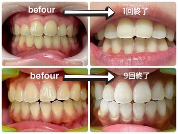 ワイズサロン(Y's salon)