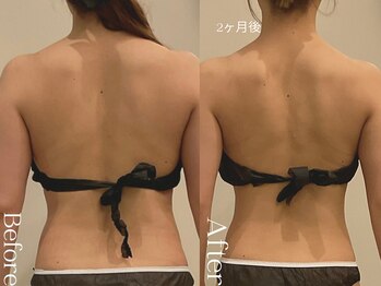 ユーフォリア グロウ(euphoria glow)/{ ラフォス痩身90分 10回 }