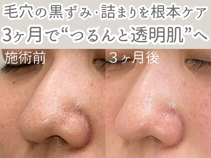 アルカンシエル(arcenciel)の写真