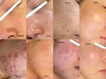 ビースキン 藤沢店(BeSkin)