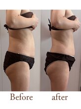 スリラ(SuriLa)/◆ビフォーアフター◆