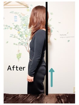 くまお整体院 新小岩本店/腰痛にお悩みの30代女性Part2