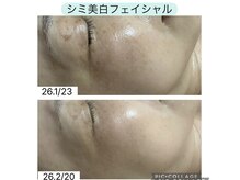 アロハカウア(Aloha Kaua)の雰囲気（【シミ・美白ケア】高濃度生プラセンタ導入ハリ◎ツヤ◎くすみ）