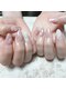 ラバーズネイル(Lover's Nail)の写真/【スカルプで長さだし】入学や新学期など春のイベントに向けて爪の形やトラブルにとらわれず理想を叶える☆
