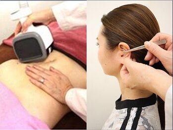 スーパースリムダイエット 相模大野の写真/何をやっても痩せないとお悩みの方！耳つぼ施術＋食生活カウンセリングが解決！短期集中～大幅ダイエット♪