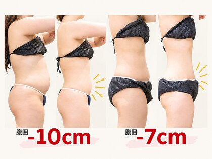 腸と頭の写真