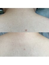 トリップ(trip)/毛穴レス美肌