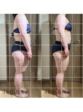 ベルルーナ(Belle-Lune)/ビフォーアフター