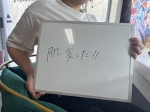 ラビ(RABBI)/20代女性水光ピーリングのお客様