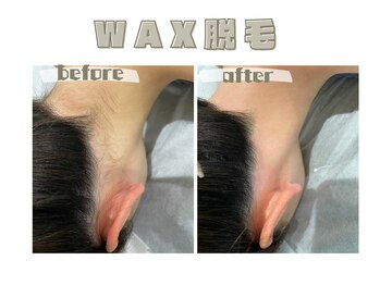 レヴィート(Revept)/【ワックス脱毛】