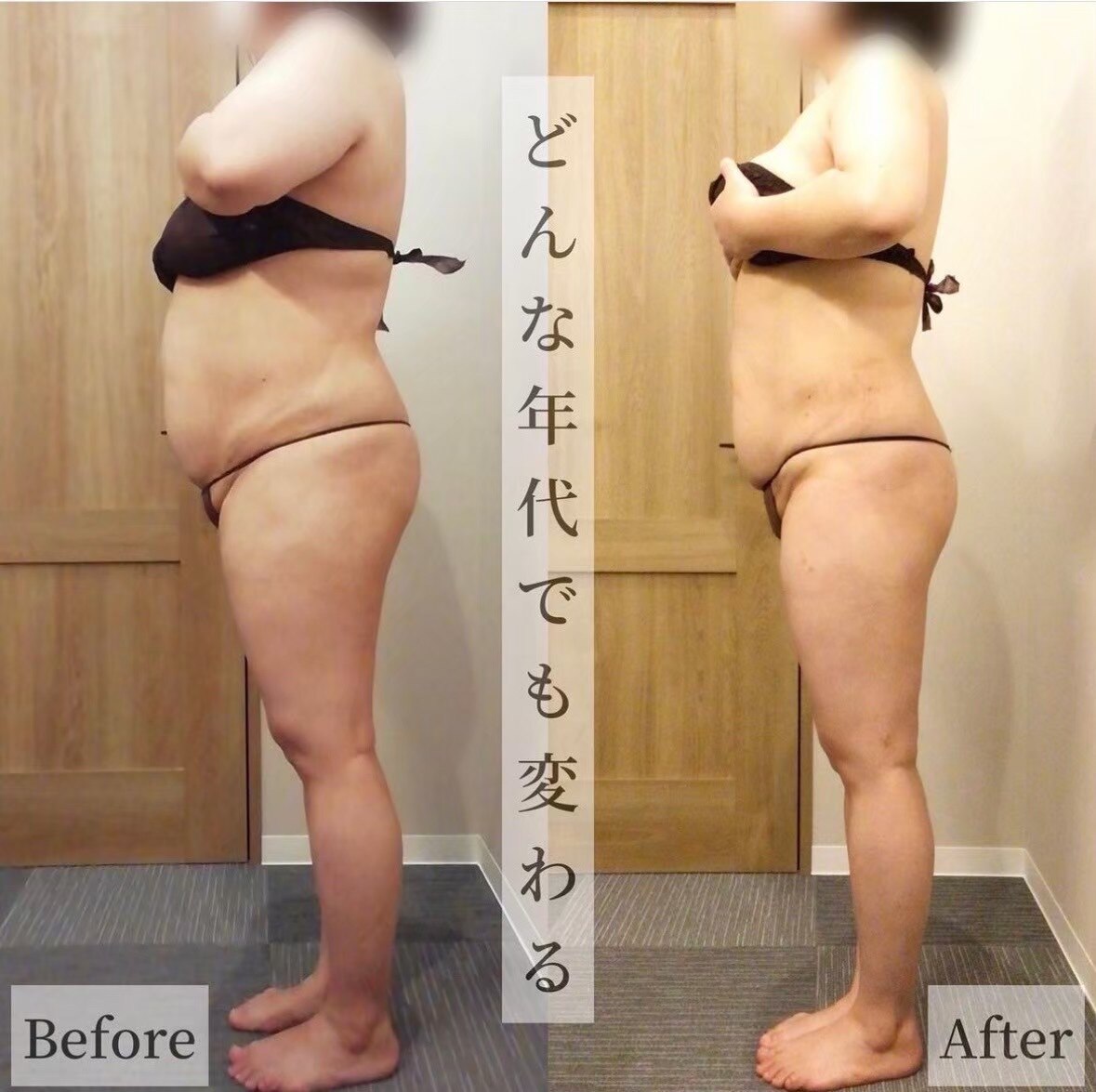 【1日3名様限定★】全身痩身♪4Dシェイプ+ハイパーナイフ+全身リンパ《90分》