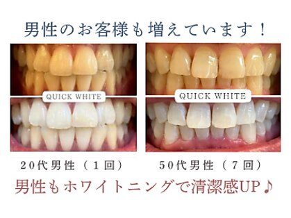 クイック ホワイト(QUICK WHITE)の写真