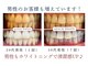 クイック ホワイト(QUICK WHITE)の写真
