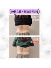 グランディールアン(GRANDIR UN)/腰のお肉もとれます