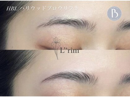 リリム(Lrim)の写真