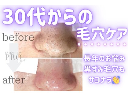 ジール(GIILL)の写真