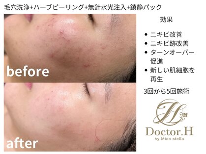 ドクターエイチ 麻布十番店(Doctor.H)の写真