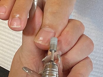 ネイルミオ (Nail-MIO)の写真/ディプロマ取得のプロが爪の補正するので安心して通っていただけます◎爪の悩みやアートの相談もお気軽に♪