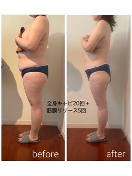 バンブー(bamboo)/ビフォーアフター