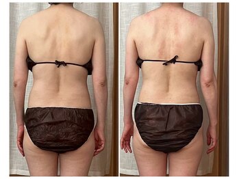 マイティー整骨院 ココア(CoCoa)/活性リンパ洗浄