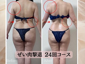 ハナチュチュ 矢場町店(Hanachuchu)/