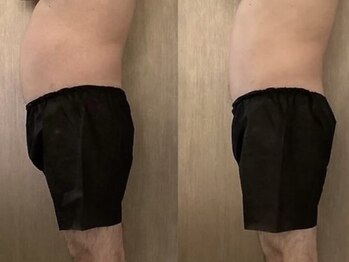 ラズリ(Lazuli)/メンズ3max 60min込み込み