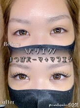 ドース(DOSE)/輝く目元