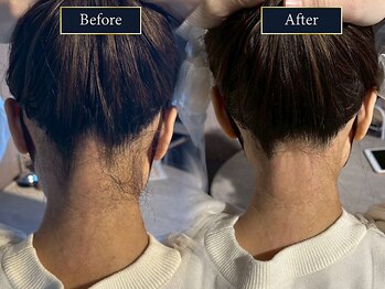 グラスト(Grast)/デザイン次第で柔らかい首元に♪