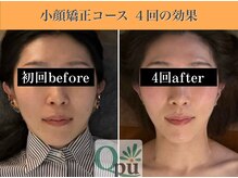 キュープ 表参道店(Qpu)/続けた方しか感じられない変化♪